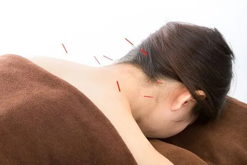 针灸配合皮内针疗法治疗失眠的方法 经常去做可以吗？