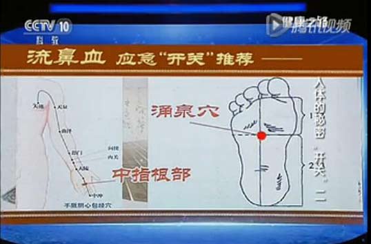 流鼻血怎么办