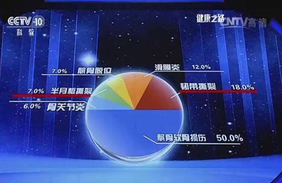 膝关节损伤类型