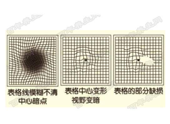 阿姆斯勒表