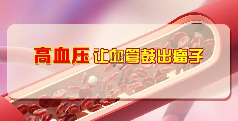 警惕血管里鼓出来的“定时炸弹”