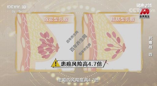 致密型乳腺的患癌风险比脂肪型乳腺高4.7倍