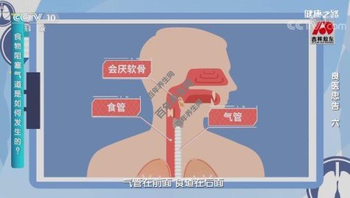 食物阻塞气道是如何发生的