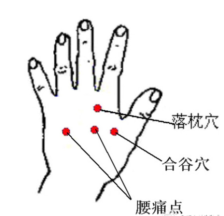 落枕按一个穴位就搞定