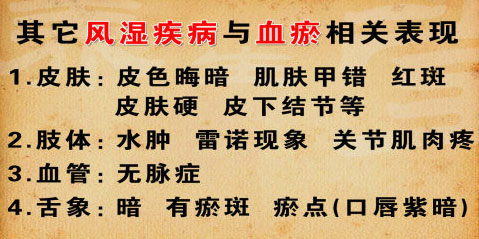 其他以关节炎为主要表现的疾病都会有血瘀的表现