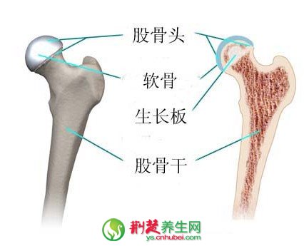 股骨头坏死早期症状四大信号