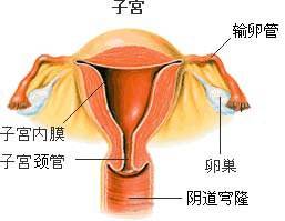 子宫内膜异位的发病因素有哪些