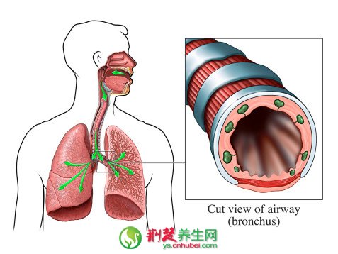 治疗支气管炎不宜使用抗菌药