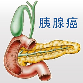 为什么会得胰腺癌 诱发胰腺癌的因素