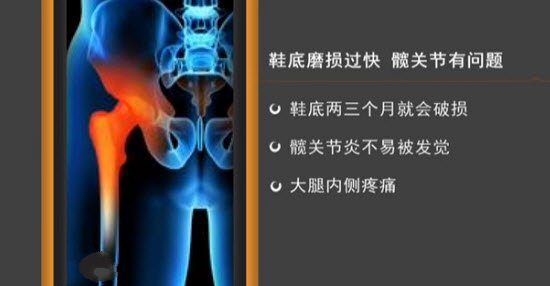 从鞋底磨损程度看膝盖问题