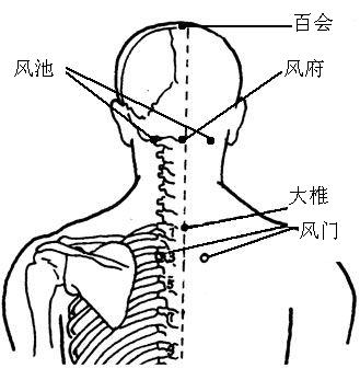 夏季感冒怎么办 可以尝试艾灸治疗