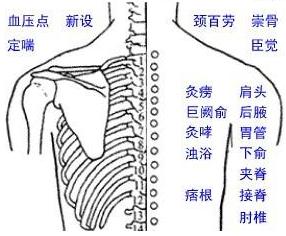 颈百劳穴