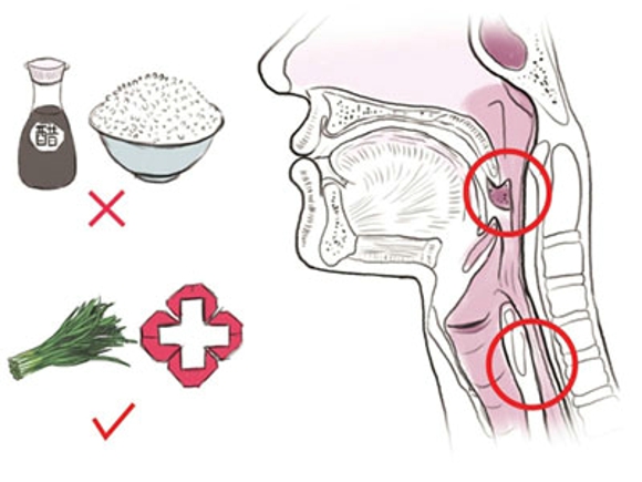 鱼刺卡喉怎么办  谨记这十个日常秘方