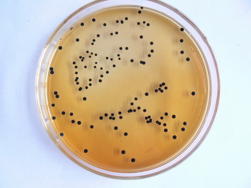 美国多地爆发沙氏门菌感染 了解沙门氏菌食物中毒
