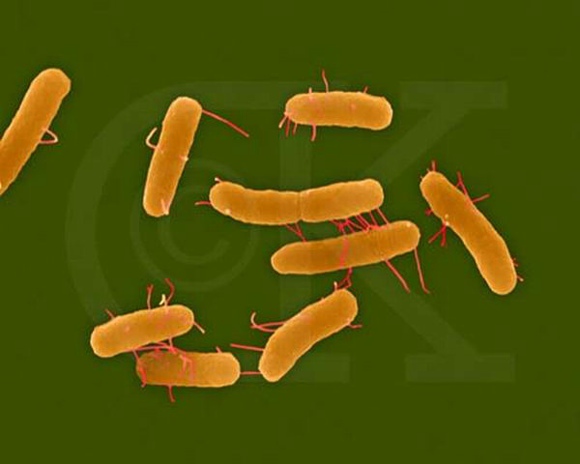 美国多地爆发沙氏门菌感染 了解沙门氏菌食物中毒