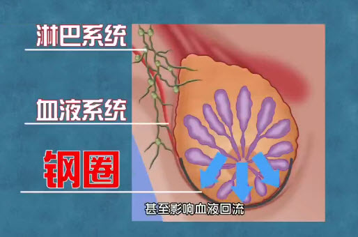 带钢圈的乳罩不好