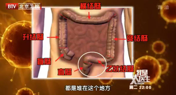 粪便移植术