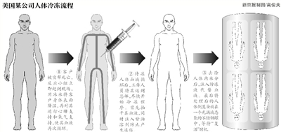 女作家冷冻遗体盼复活 揭秘遗体冷冻复活靠谱吗