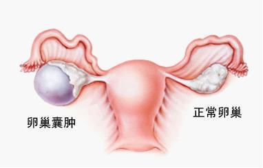 女性卵巢保养方法 破坏卵巢的恶习你有吗