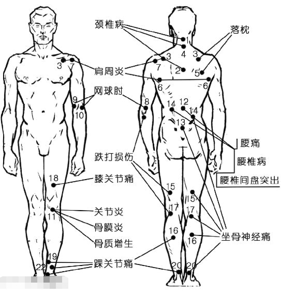 女人穴位养生 四大穴位让你青春永驻