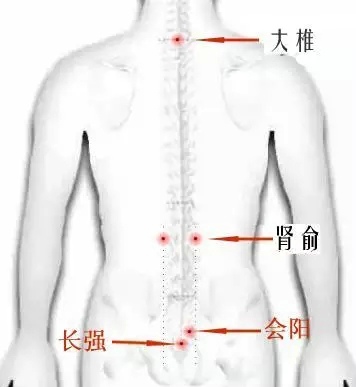 针灸治痔疮 这些穴位你可以掌握