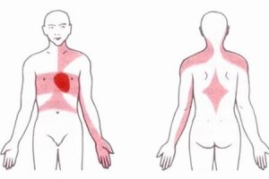 心肌缺血的症状有哪些 心肌缺血的按摩手法