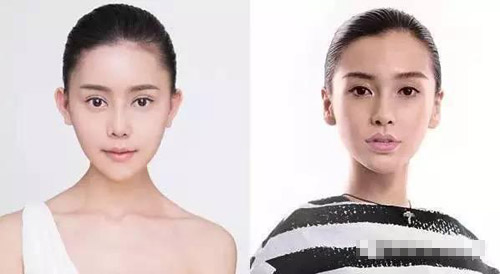 女大学生自爆整形日记 花了百万整成Angelababy