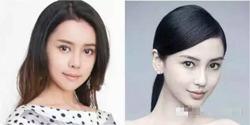 女大学生自爆整形日记 花了百万整成Angelababy(3)