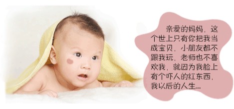 英国女婴额头心形胎记 如爱神丘比特(3)