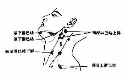 妙龄女孩患怪病：全身血肉模糊 一月暴瘦十斤(3)