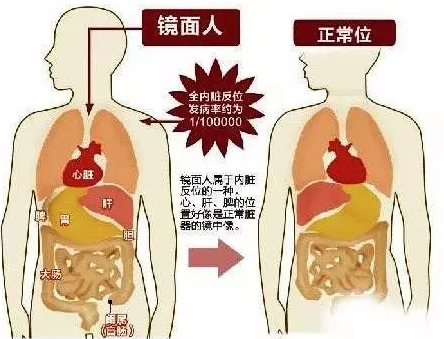 男婴心肝肺肠胃全长反 几率仅百万分之一