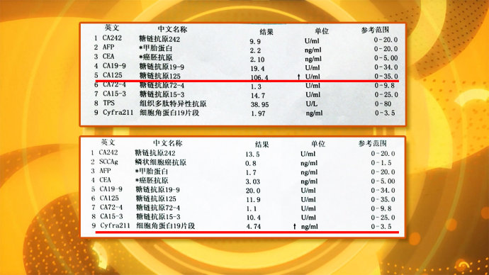 2016年7月2日播出《发现癌的踪迹》