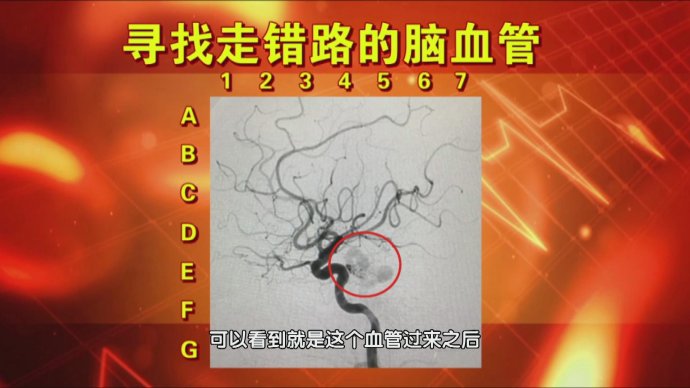 2017年7月1日播出 《健康才有最强大脑-血管（1）》