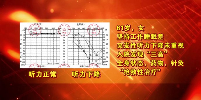 2018年1月5日播出 走进十年特别节目之权威系列三-《小五官带来的大危机》