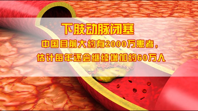 2018年8月1日播出《腿脚上的“寿命地图”》