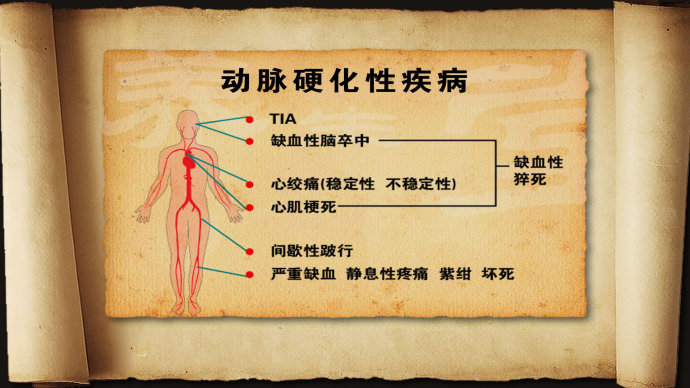 2015年2月10日播出《从血管看寿命—1》