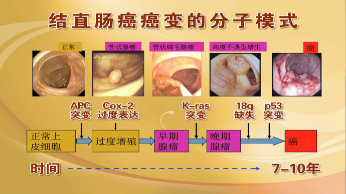 2015年6月8日播出《难以察觉的致命息肉》