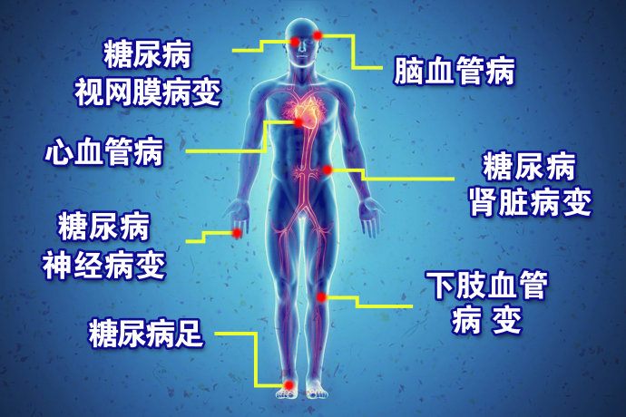 2015年11月29日播出《解密有“个性”的糖尿病—3》