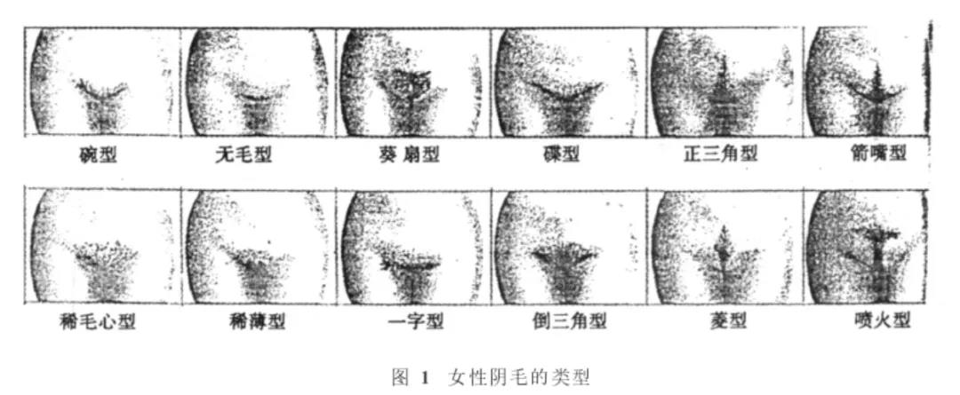 私处毛毛的疏密