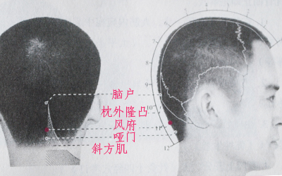 风府穴位位置图