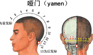 哑门穴