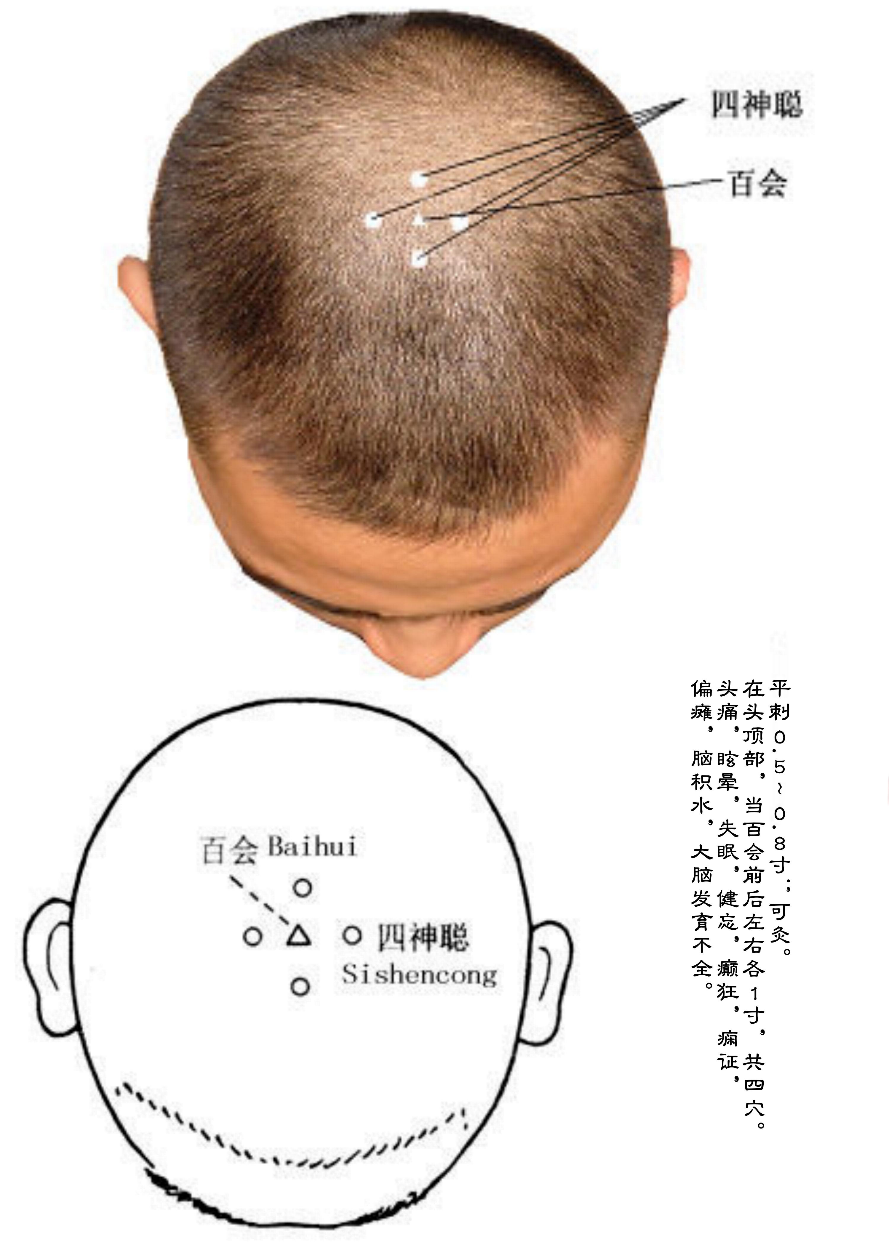 针灸经脉穴位图则之四十三（经外奇穴图则之一）