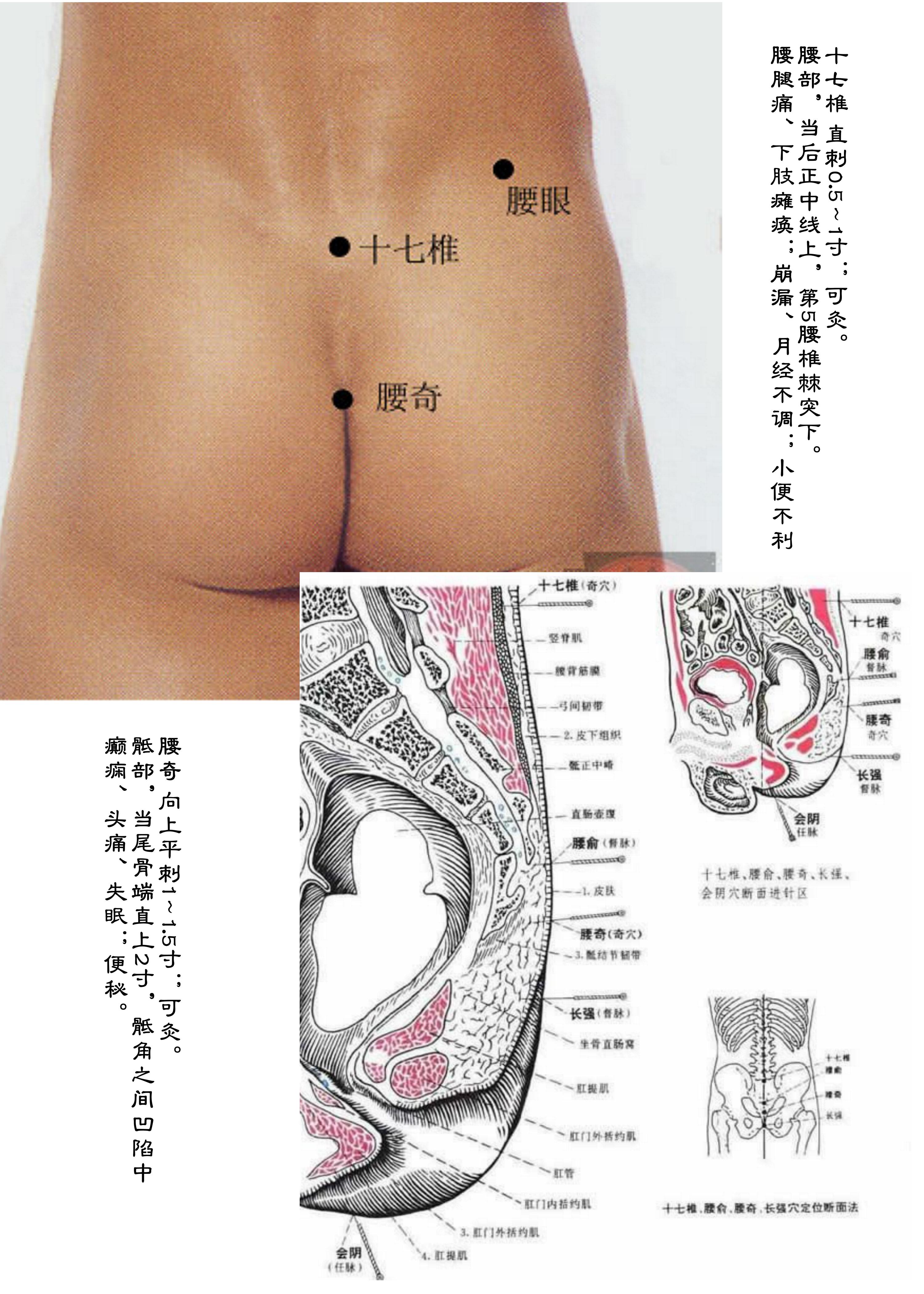 针灸经脉穴位图则之四十四（经外奇穴图则之二）