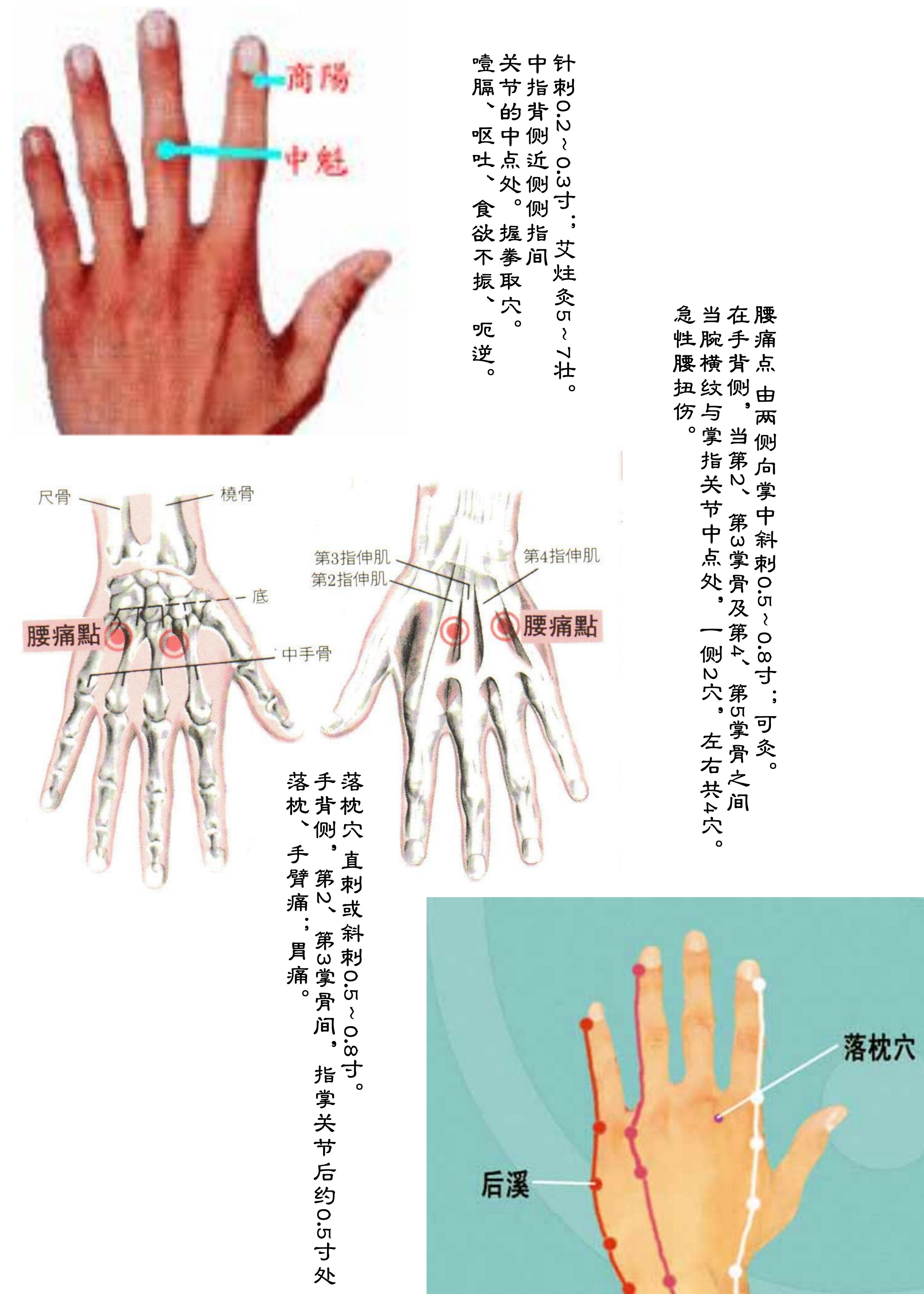 针灸经脉穴位图则之四十四（经外奇穴图则之二）