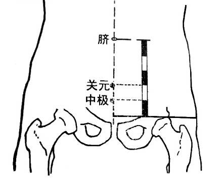 中极穴的准确位置图