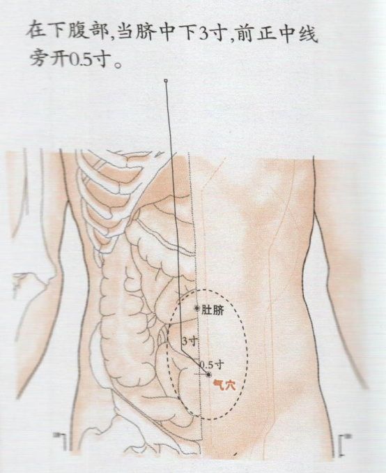 气穴