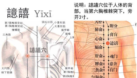 譩譆穴